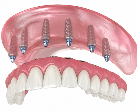 teeth image